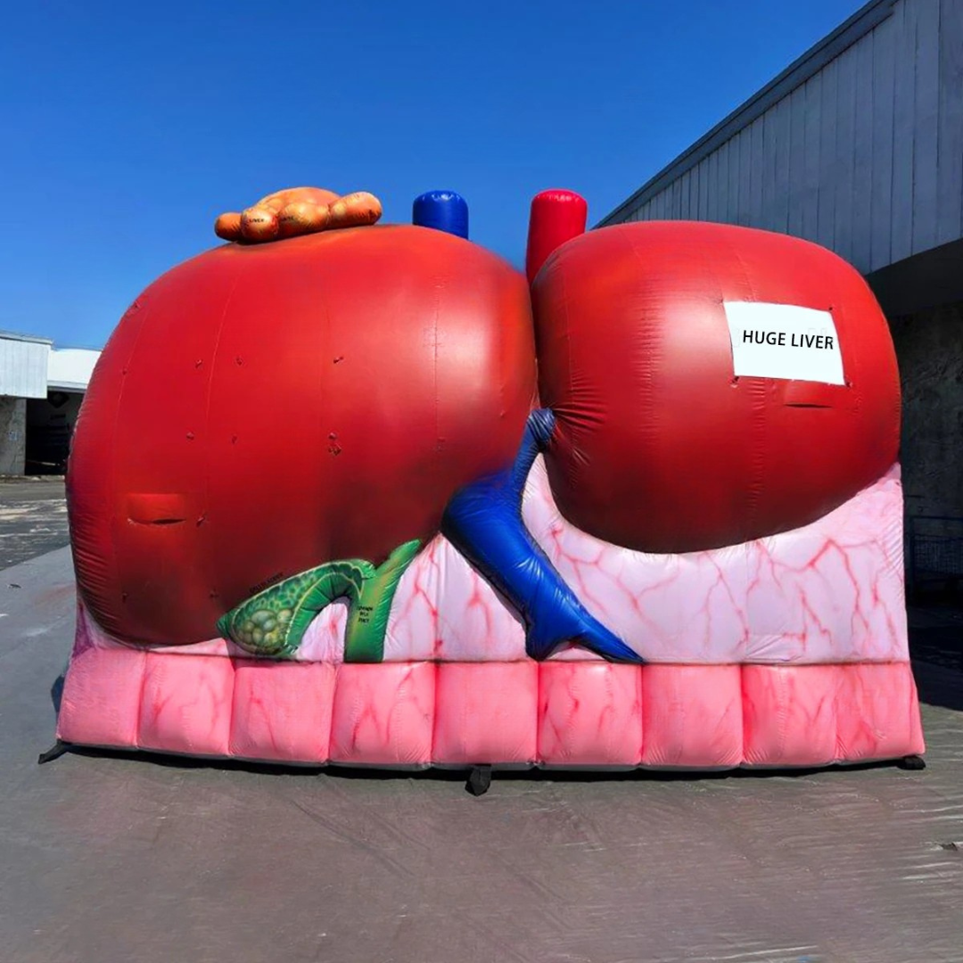 Giant Inflatable Liver Model for Medical Exhibitions
